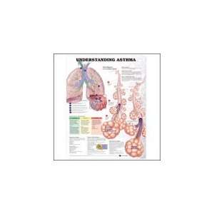  PT# 1587799383 Understanding Asthma Anatomical Chart 2nd 