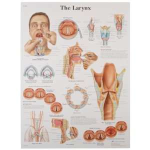   Chart (Larynx Anatomical Chart, French), Poster Size 20 Width x 26