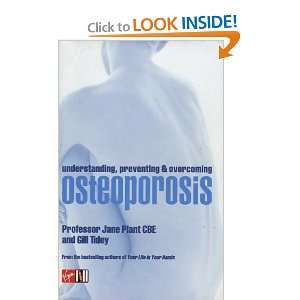  Understanding, Preventing and Overcoming Osteoporosis 